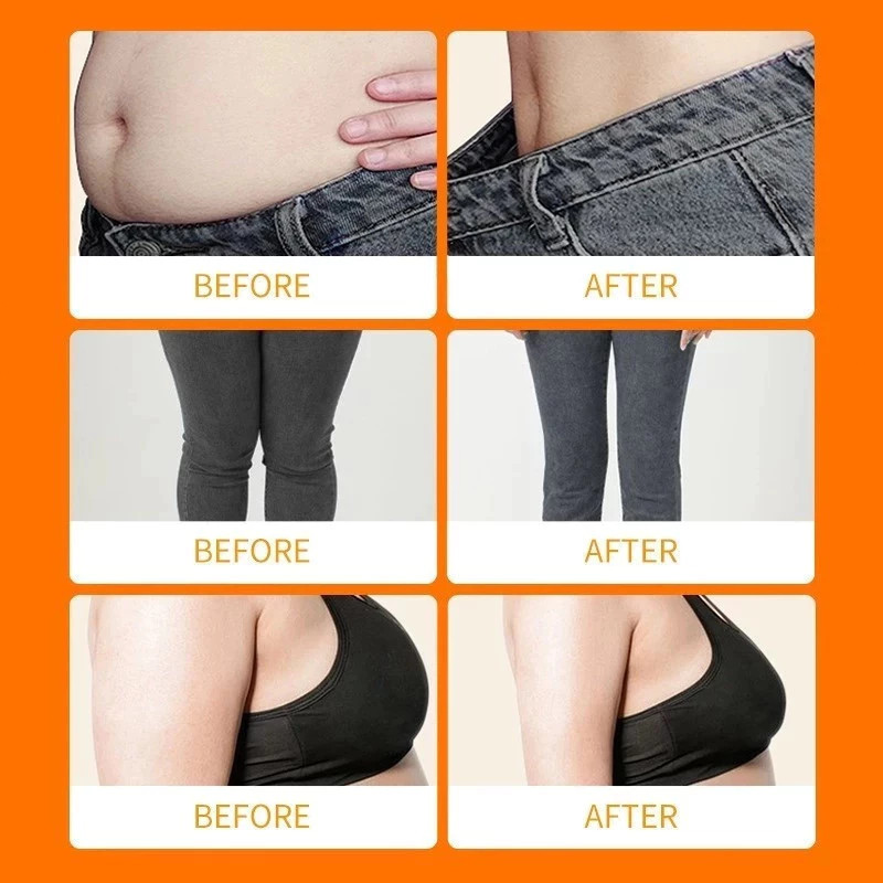 100% sẵn sàng cho hàng Kem đốt cháy mỡ Giảm béo toàn thân Kem mỏng chuyên nghiệp Một mùa xuân Kem giảm béo cho bụng 100% sẵn sàng cho hàng Kem đốt cháy mỡ Giảm béo toàn thân Kem mỏng chuyên nghiệp Một mùa xuân Kem giảm béo cho bụng
