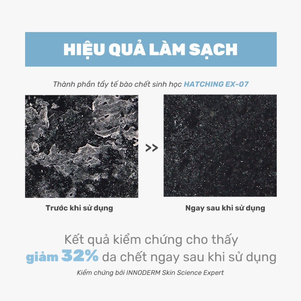 Nước hoa hồng Round Lab 1025 Dokdo Toner bổ sung độ ẩm làm dịu da Nước hoa hồng Round Lab 1025 Dokdo Toner bổ sung độ ẩm làm dịu da