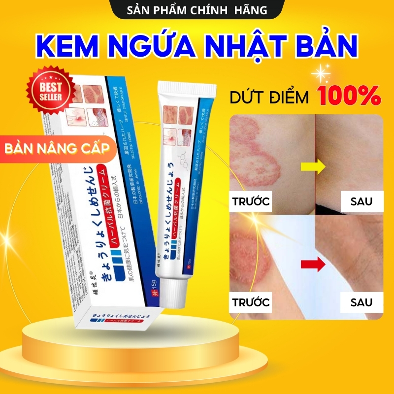 Kem Bôi Viêm Da Cơ Địa NHẬT BẢN Hết Lác Đồng Tiền, Hắc Lào, Ghẻ Nước, Á Sừng Cực Kì Hiệu Quả Kem Bôi Viêm Da Cơ Địa NHẬT BẢN Hết Lác Đồng Tiền, Hắc Lào, Ghẻ Nước, Á Sừng Cực Kì Hiệu Quả