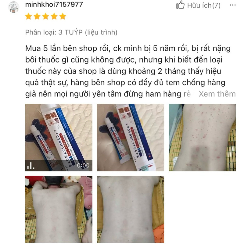 Kem Bôi Viêm Da Cơ Địa NHẬT BẢN Hết Lác Đồng Tiền, Hắc Lào, Ghẻ Nước, Á Sừng Cực Kì Hiệu Quả Kem Bôi Viêm Da Cơ Địa NHẬT BẢN Hết Lác Đồng Tiền, Hắc Lào, Ghẻ Nước, Á Sừng Cực Kì Hiệu Quả