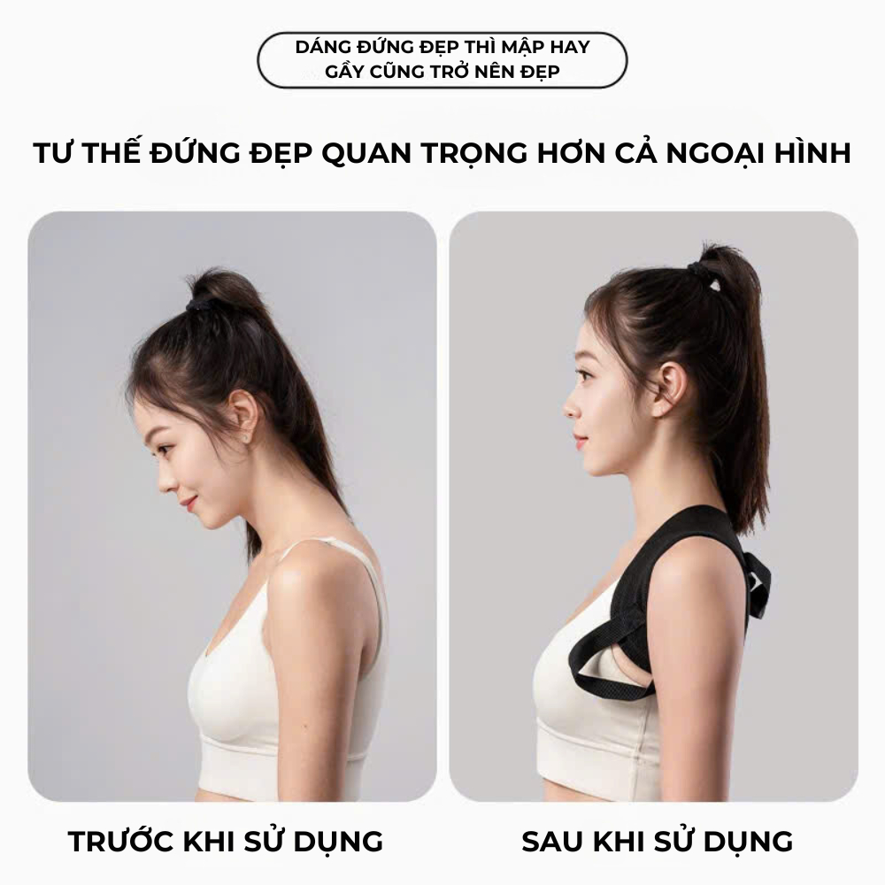 Đai Chống Gù Lưng Homie Space Hỗ Trợ Cột Sống - Dành Cho Mọi Đối Tượng - Đeo Thoải Mái, Hiệu Quả Cao Đai Chống Gù Lưng Homie Space Hỗ Trợ Cột Sống - Dành Cho Mọi Đối Tượng - Đeo Thoải Mái, Hiệu Quả Cao